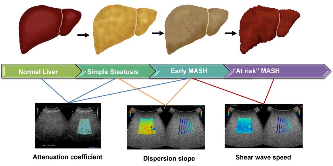 【東京医科大学】超音波画像マーカーによる肝臓の炎症、脂肪化、線維化の評価を確立　～超音波画像マーカーにより低侵襲な肝病態評価が可能～