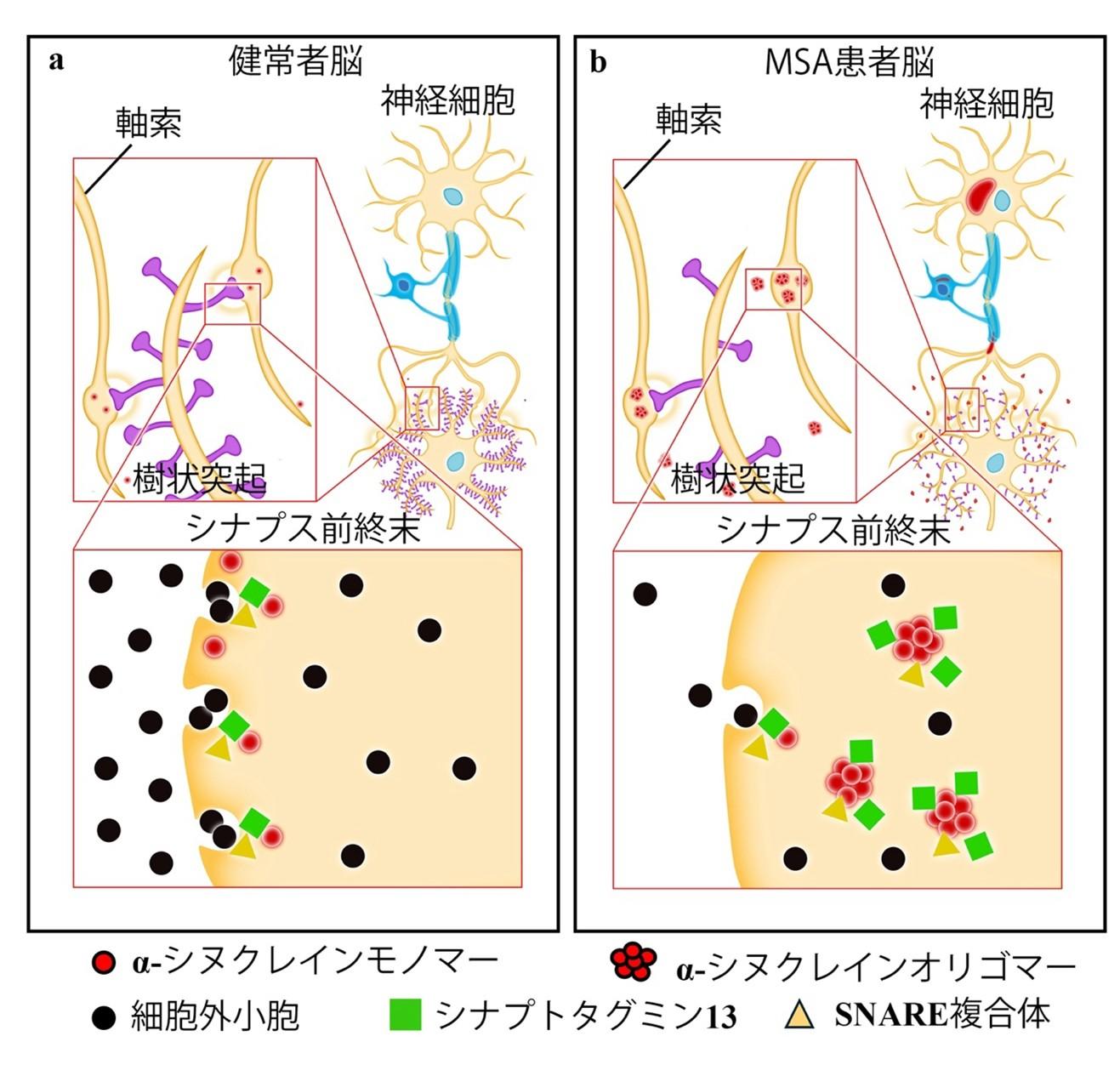 弘前大学の三木康生助教らによる研究グループがレヴィ小体型認知症や多系統萎縮症における認知症の成因を発見