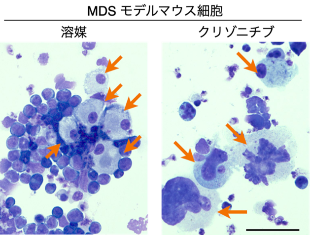 【東京薬科大学】既存肺がん治療薬クリゾチニブ新作用の発見！ ～骨髄異形成症候群の血小板減少症に対して巨核球造血促進により血小板産生を増加～
