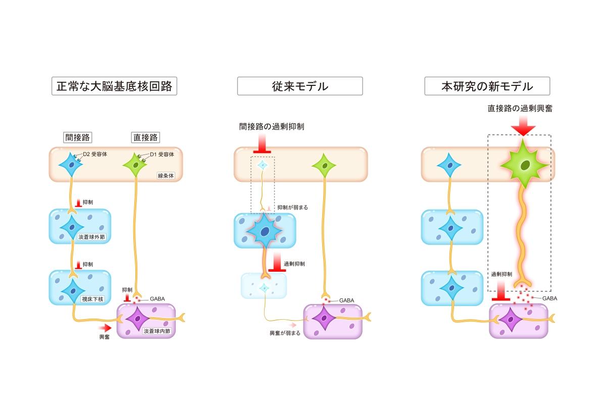 弘前大学医学研究科の引地浩基助手らの研究グループが抗精神病薬の副作用である遅発性ジスキネジアの発症機序を解明