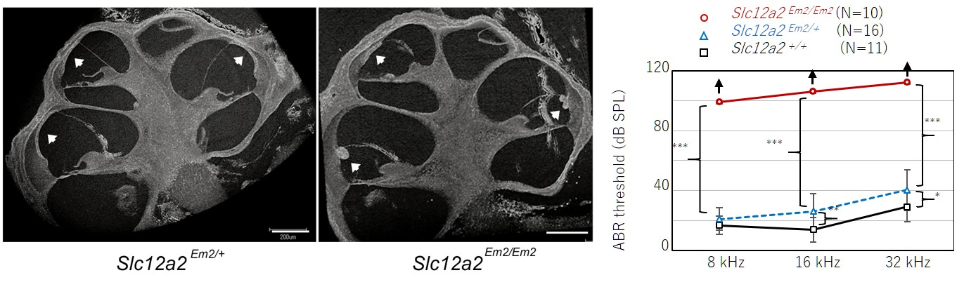 難聴の原因遺伝子SLC12A2の動物モデル開発とその病態解明－きこえない世界を減らすために－（北里大学）