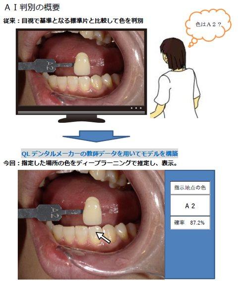 AIの技術を歯科医療に活用　明星大学情報学部植木研究室が歯科技工所と共同研究