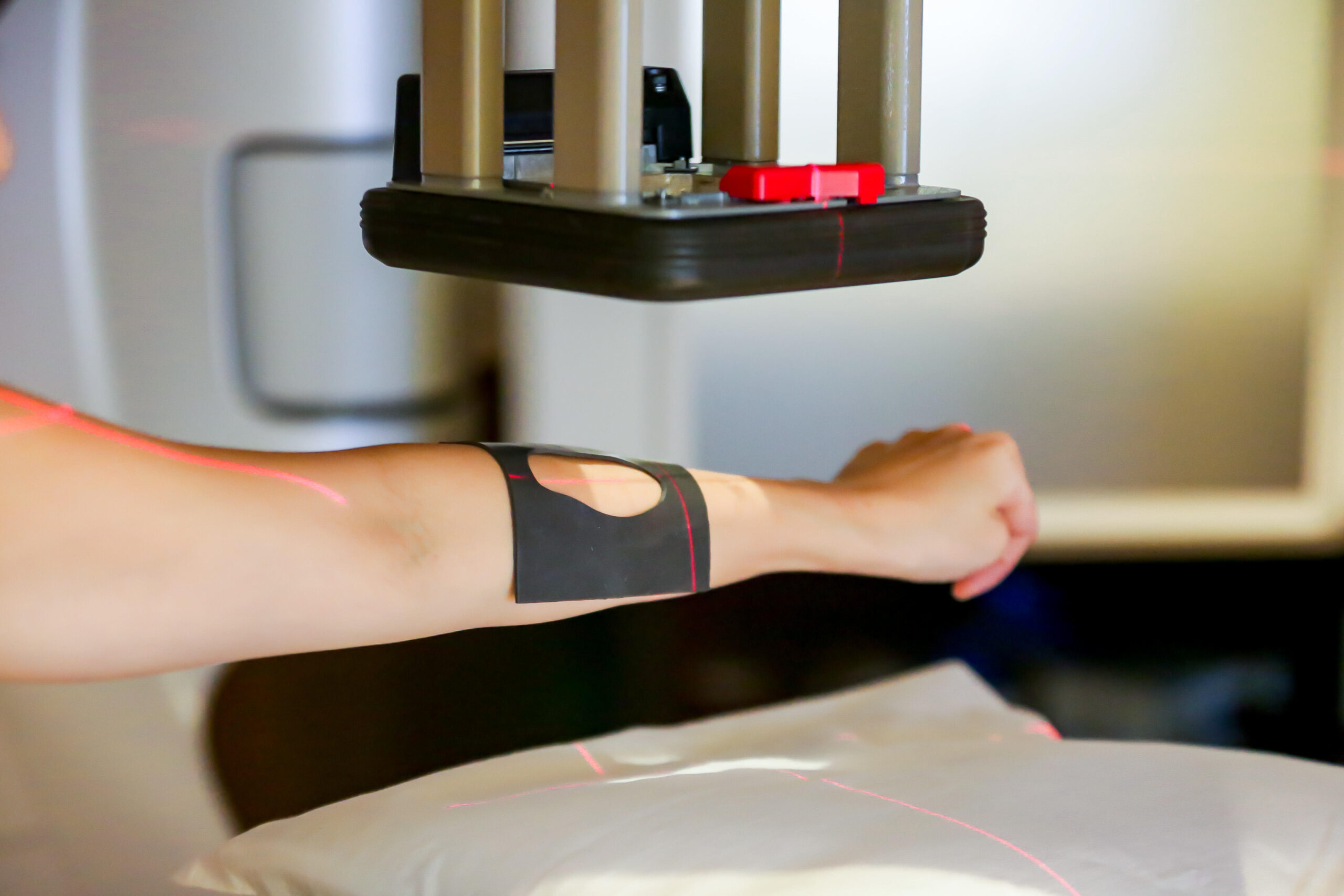 可変型の放射線遮蔽材の開発に世界で初めて成功　環境・患者様へ優しい放射線治療へ