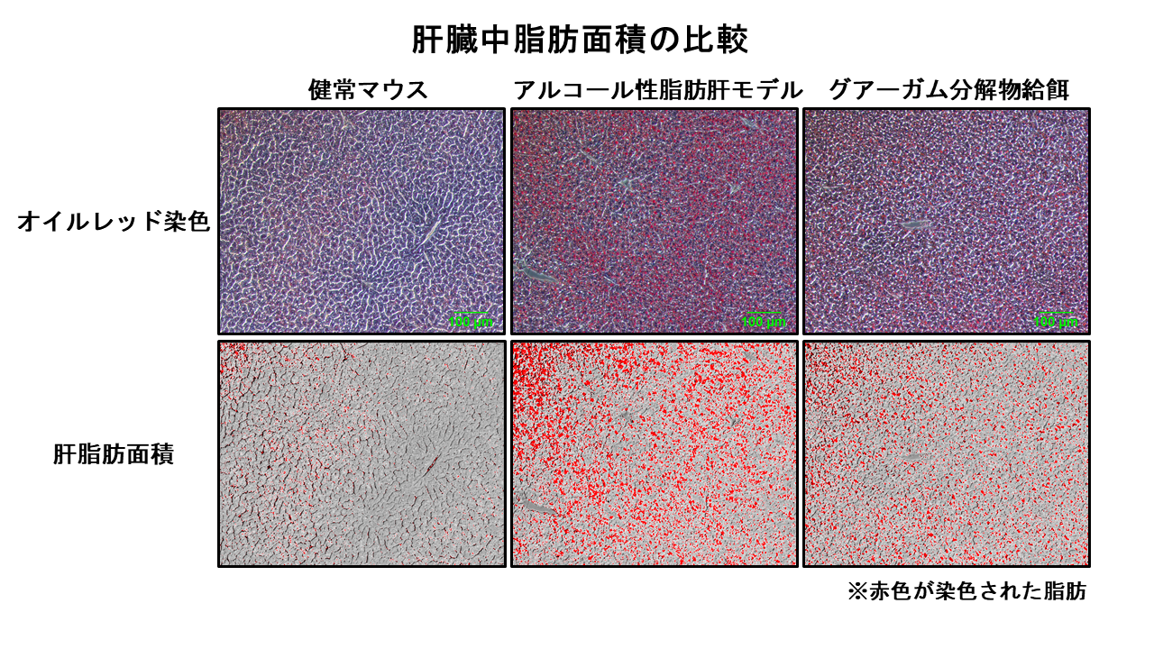 水溶性食物繊維 “グアーガム分解物” のアルコール性脂肪肝の改善効果を解明　腸内環境の改善が肝疾患の予防に有用である可能性–摂南大学