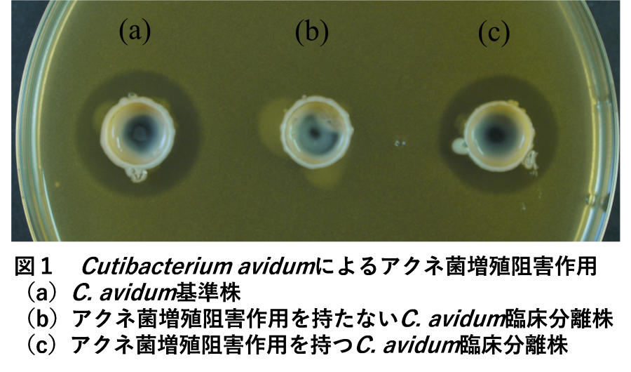 【東京薬科大学】皮膚常在菌から新規抗菌ペプチドAvidumicinを発見！–新規ニキビ治療薬のシーズとして期待–