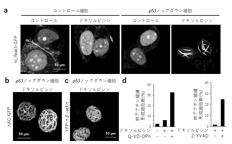 抗がん剤耐性を獲得したがん細胞に対する治療法開発へ期待。がん抑制因子p53の機能低下がもたらす抗がん剤応答への異常を新たに発見。Springer Nature 『Cell Death & Disease』で発表–甲南大学、金沢工業大学