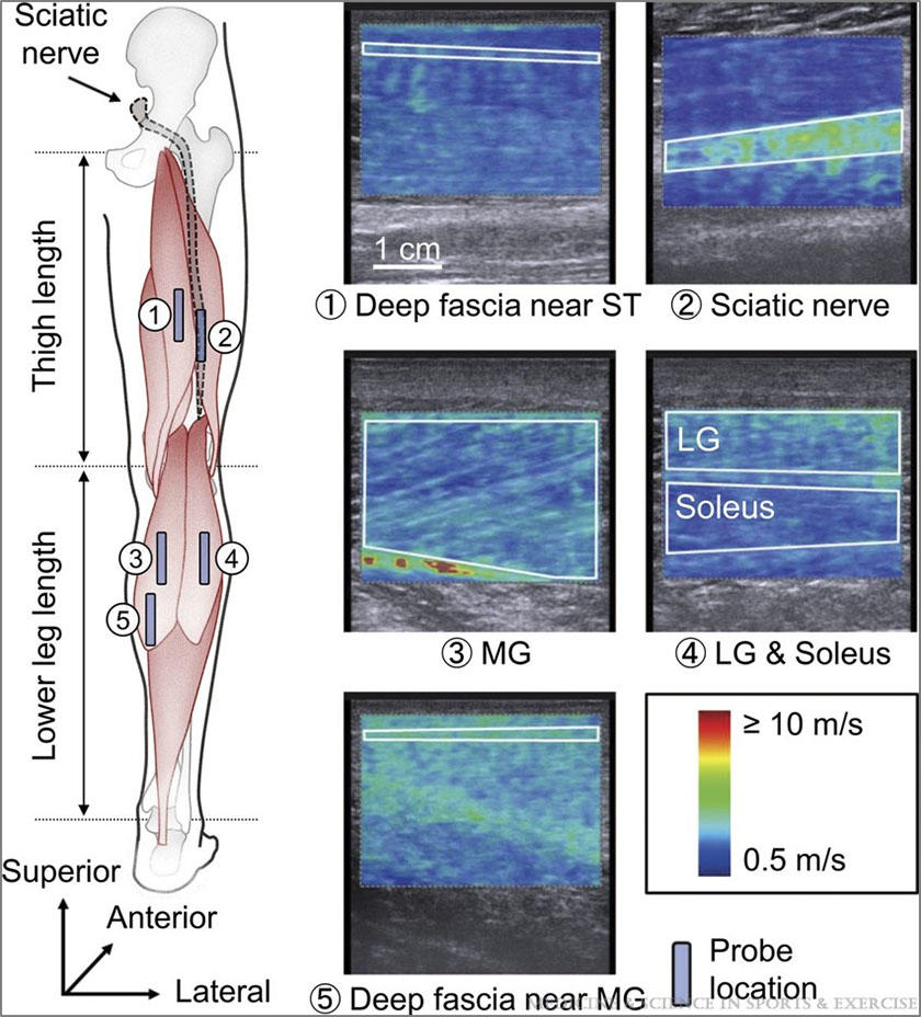 芝浦工業大学　神経の硬さが高齢者の関節の柔軟性と関連することを発見 — 年齢に応じた柔軟トレーニング開発への活用に期待 —