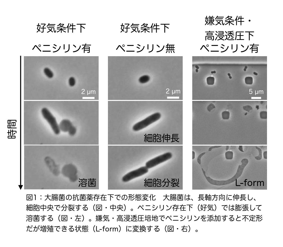 大腸菌L-formにおいて、隔壁合成はアメーバ様細胞から一定の大きさの球形細胞への変化に必要である〜進化の過程で細胞形態がどのように決められたかの考察〜