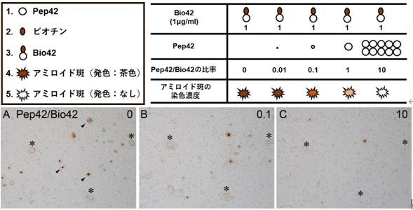 【東京医科大学】アルツハイマー病のアミロイド斑内における自己抗体の存在とその意義 ～抗体の二面性と治療薬開発におけるピットフォール～
