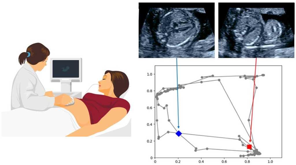 理化学研究所と昭和大学の共同研究チームが説明可能AIを用いた超音波画像診断支援の新技術を開発 — 胎児心臓超音波スクリーニングへの臨床応用に期待