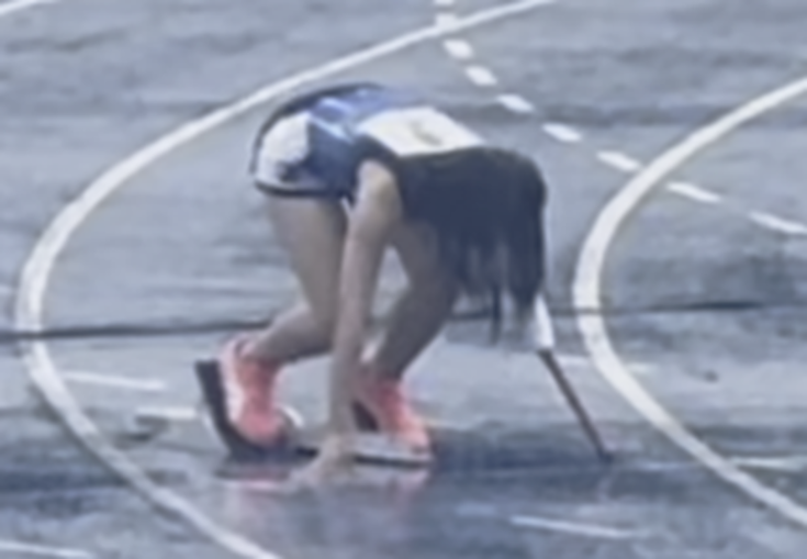 ３Ｄプリンターで成長期アスリートの義手　クラウチングスタートをかなえ、記録更新を応援–広島国際大学