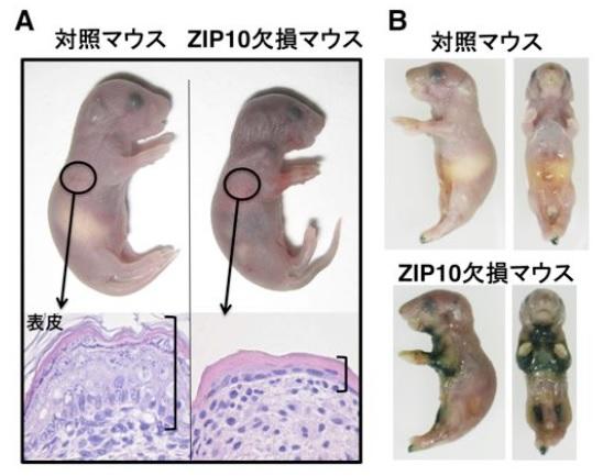 徳島文理大学薬学部の深田俊幸教授らが、アトピー性皮膚炎に関わる新たな分子を発見 — 体内の亜鉛を運搬するZIP10が関与することを世界で初めて明らかに