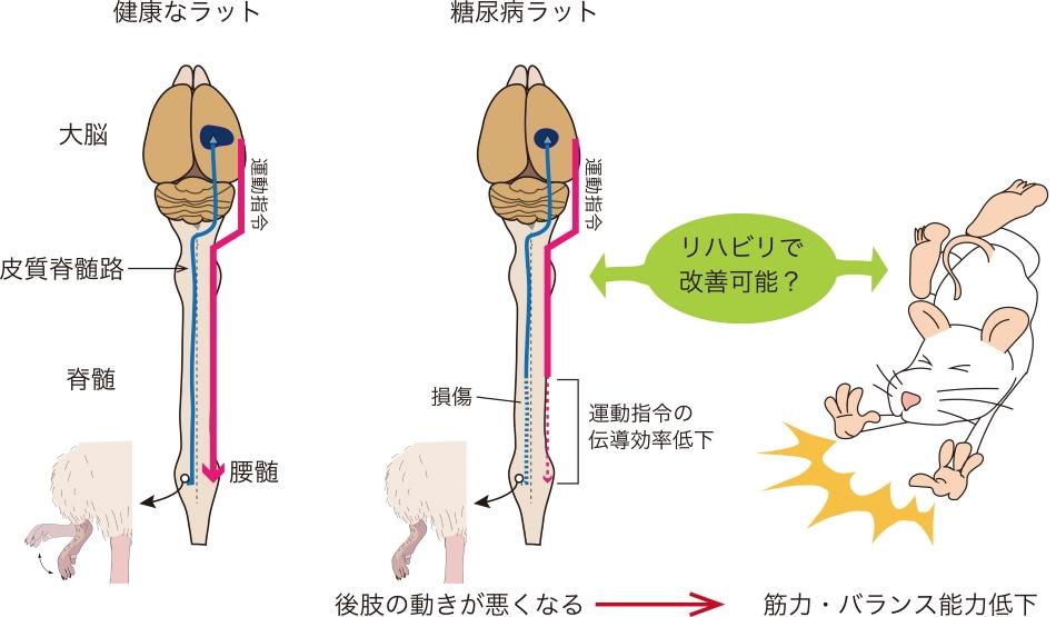 【杏林大学】糖尿病によって損傷した脳や脊髄に迂回路を作り出すスキル運動の効果を実証 — 新しい糖尿病運動療法の開発への応用が期待