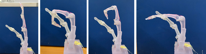 限りなく自然な電動義手に関する研究論文を大学院生が国際学術誌で発表