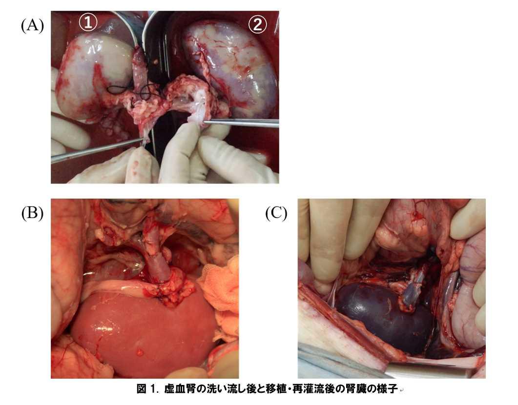 移植時の水素ガス含有保存液は循環停止したドナー腎臓の慢性拒絶を防止する — 北里大学