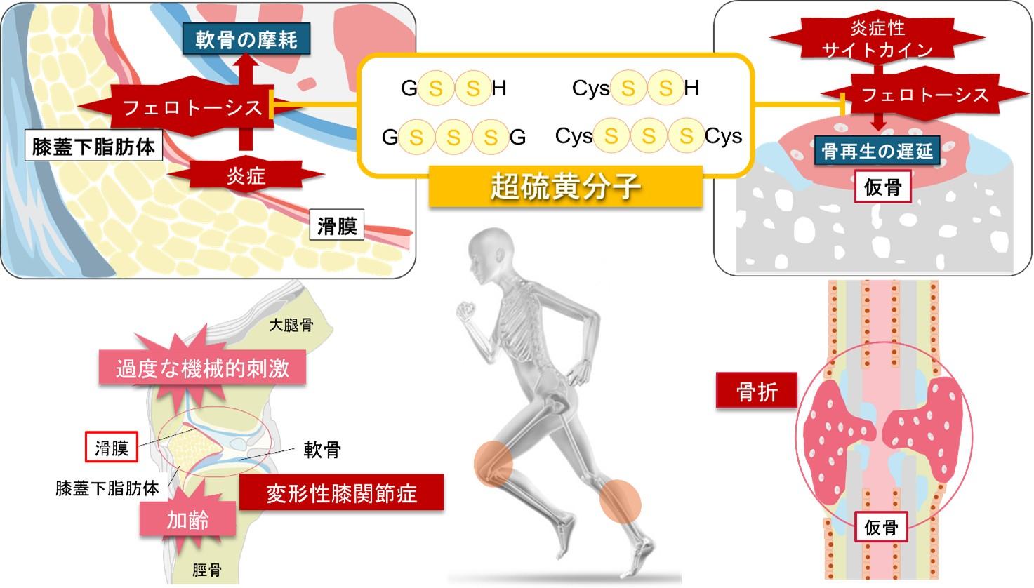 超硫黄分子の新知見！　超硫黄分子が拓く 骨再生・変形性関節症の新たな治療戦略