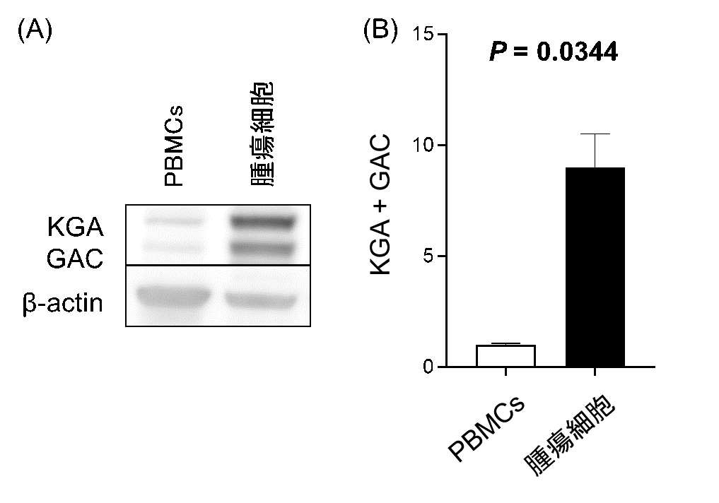 イヌの消化器型リンパ腫に対する新たな治療標的を発見　―グルタミン代謝の阻害が腫瘍細胞の増殖を抑制―（北里大学）