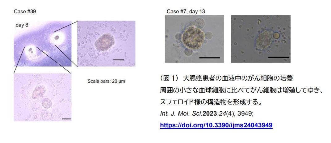 【大阪大学】大学院医学系研究科が住友ゴム工業株式会社との共同研究を開始 ― 個々のがん患者にあった治療薬を届けるコンパ二オン診断を目指して