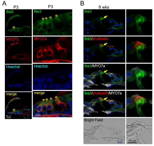 Gタンパク質共役型受容体Bai3欠損マウスは蝸牛形成異常と難聴を呈する–音を感知する末梢感覚器が、強くしなやかな構造を維持するメカニズムの一端を解明–北里大学