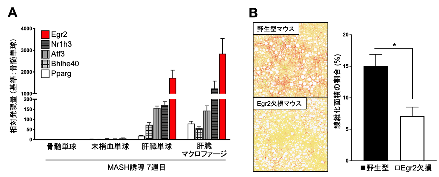 肝臓の線維化マクロファージが作られる機序を解明～代謝障害関連脂肪肝炎の新規治療法の開発に期待～