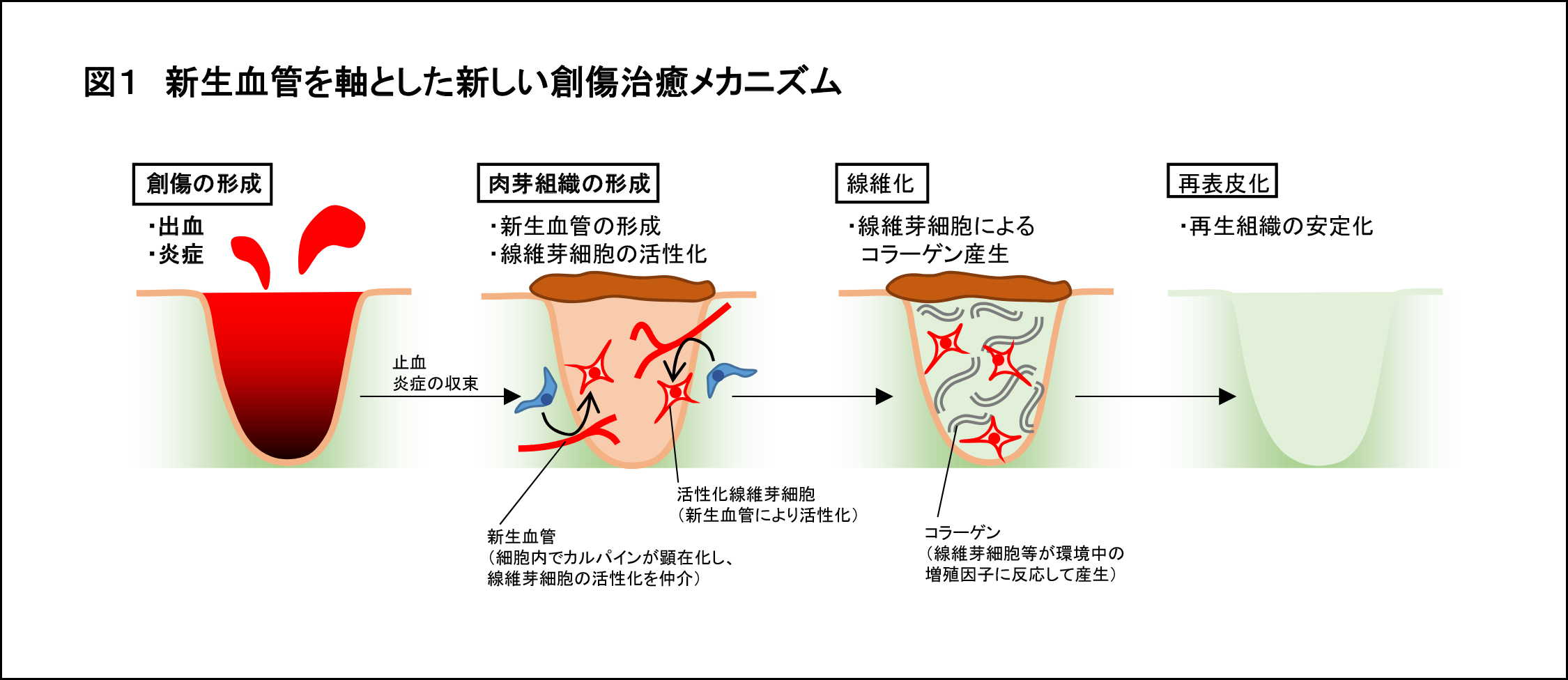 傷の治癒に関する新たな仕組みを解明 — 毛細血管が皮膚の修復をコントロールする — 昭和大学