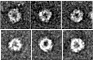 京都産業大学総合生命科学部 永田和宏教授らの研究グループが、モヤモヤ病の発症に関わるタンパク質ミステリンの構造を解明