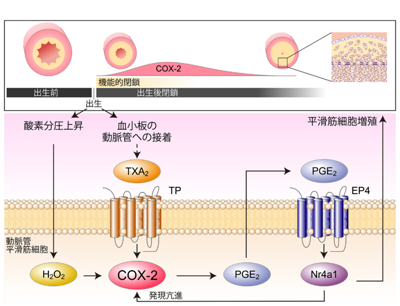 【東京医科大学】動脈管開存症に対するシクロオキシゲナーゼ阻害薬の投与タイミングに新たな科学的根拠 ～出生後のCOX-2増加が動脈管の解剖学的閉鎖を促進～