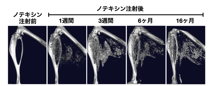 石灰化筋壊死症を再現する新規マウスモデルを確立