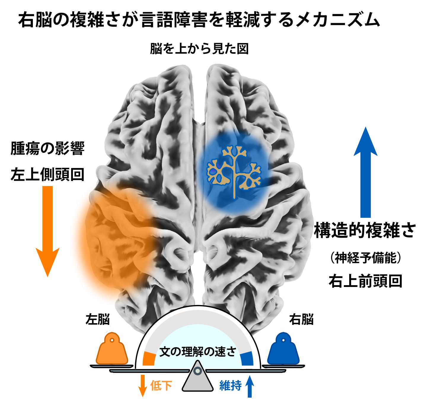 【昭和医科大学】左脳の脳腫瘍による言語障害の個人差を解明 ― 右半球の「構造的複雑さ」が言語処理速度を維持する予備能として機能する可能性を示唆 ―