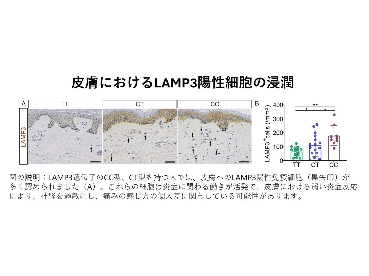 弘前大学大学院医学研究科の研究グループが岩木健康増進プロジェクトデータを用いて痛覚に関連する新しい一塩基多型を解明