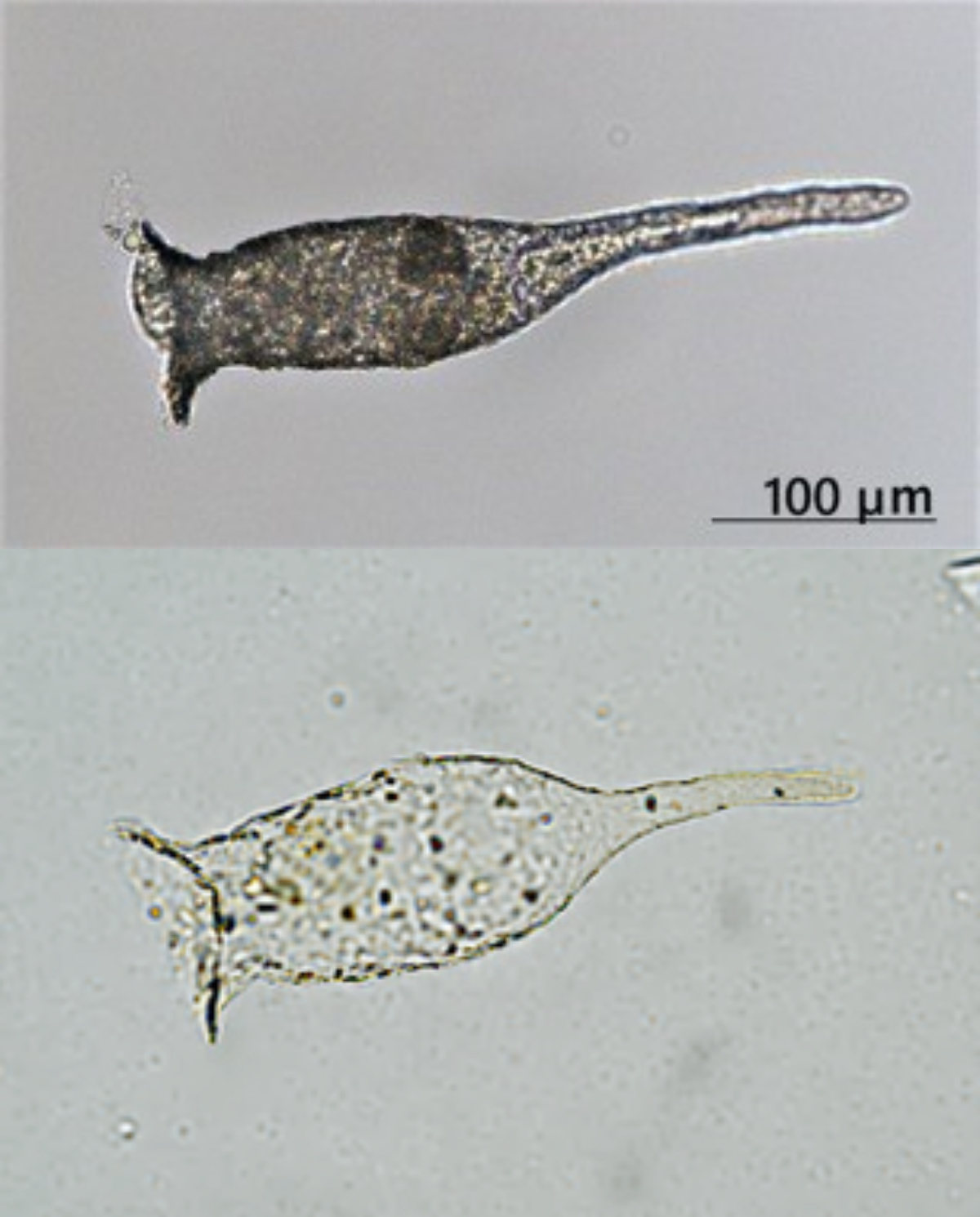琵琶湖の絶滅危惧プランクトン「ビワコツボカムリ」は日本固有の亜種だった ～中国産個体群を新亜種「ムーランツボカムリ Difflugia biwae junyangi」として記載〜