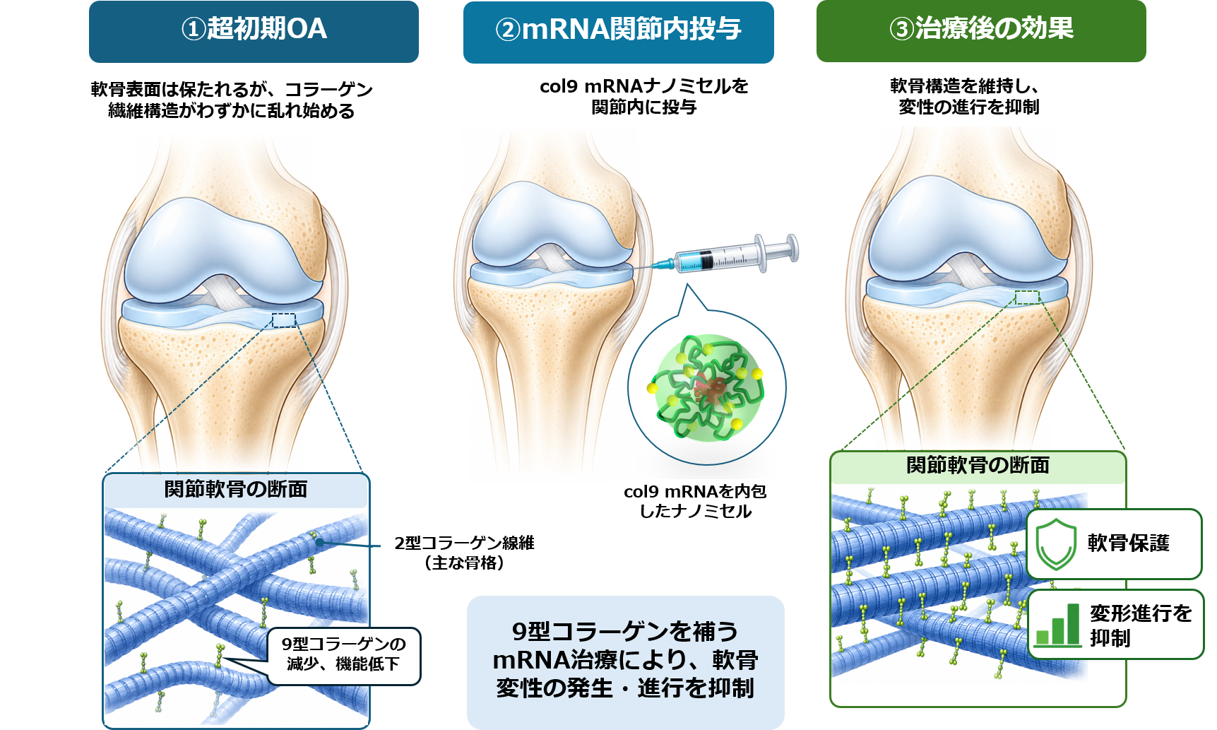 mRNA創薬の新展開！ 軟骨が壊れ始める“最初の一歩”をmRNAで食い止める ― 「疾患を治療する」から「疾患を成立させない」変形性関節症治療へ ―